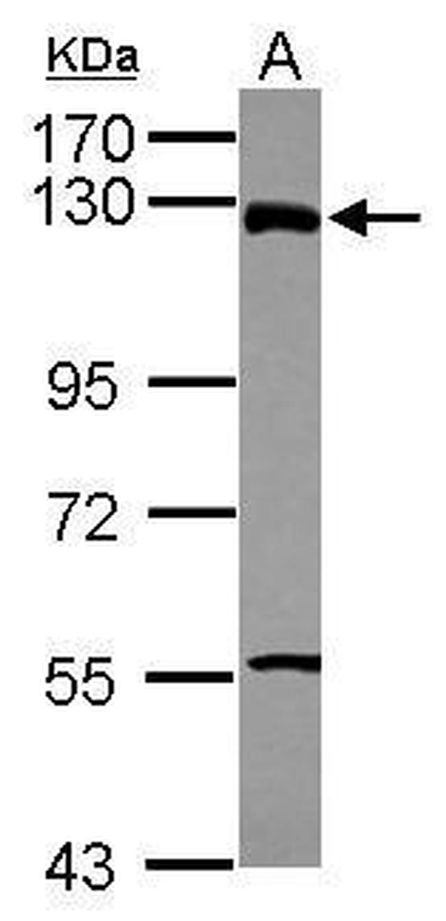 ZNF295 Antibody in Western Blot (WB)