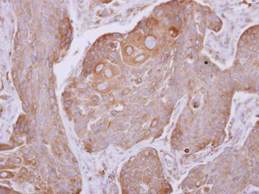 Dynactin 4 Antibody in Immunohistochemistry (Paraffin) (IHC (P))