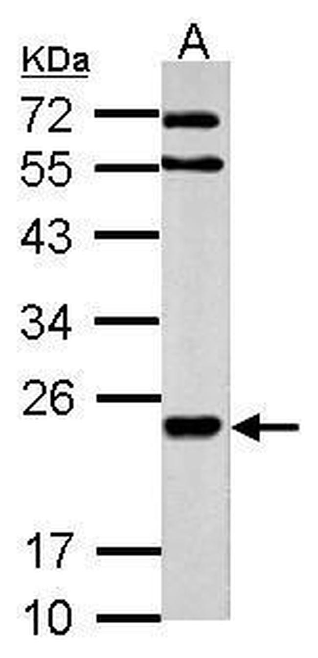 MARCH2 Antibody in Western Blot (WB)