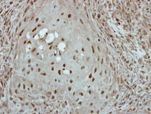 KLF3 Antibody in Immunohistochemistry (Paraffin) (IHC (P))
