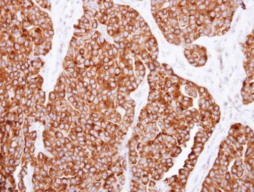 SNX7 Antibody in Immunohistochemistry (Paraffin) (IHC (P))