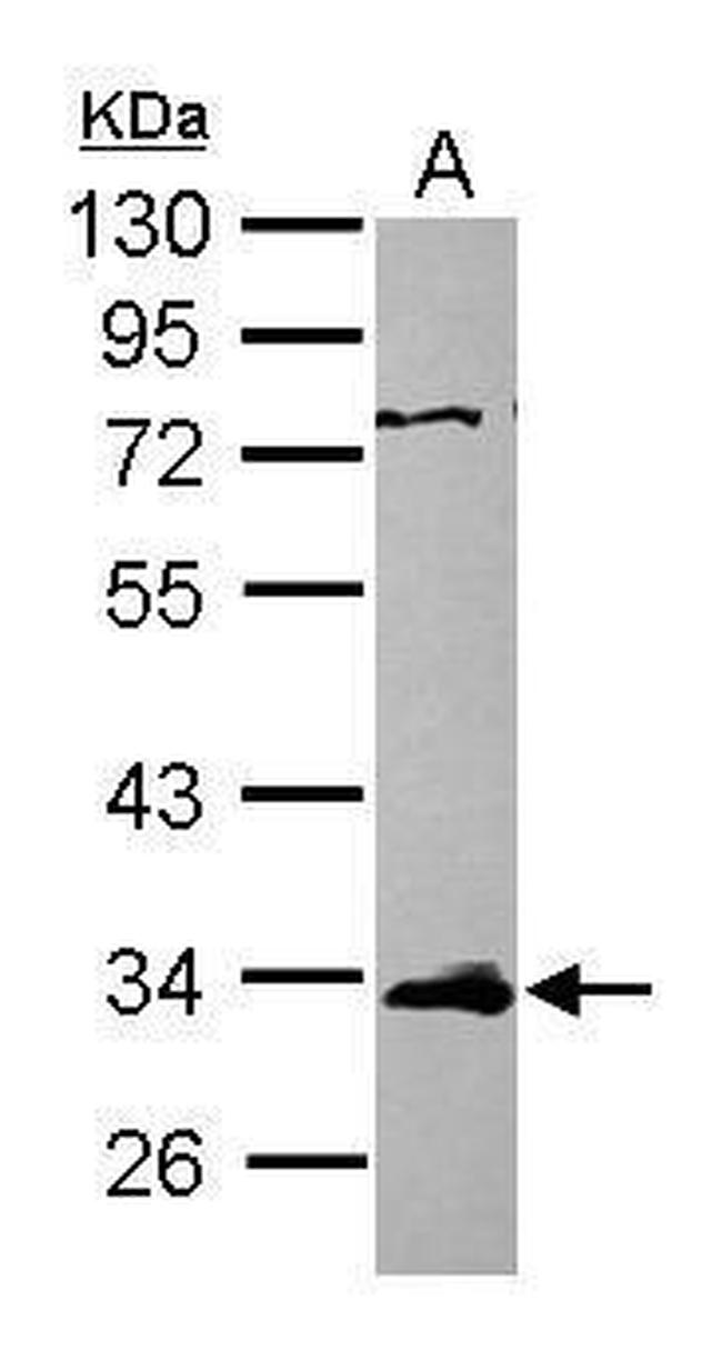 ETV7 Antibody in Western Blot (WB)