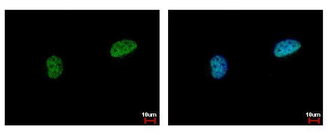 PIASy Antibody in Immunocytochemistry (ICC/IF)