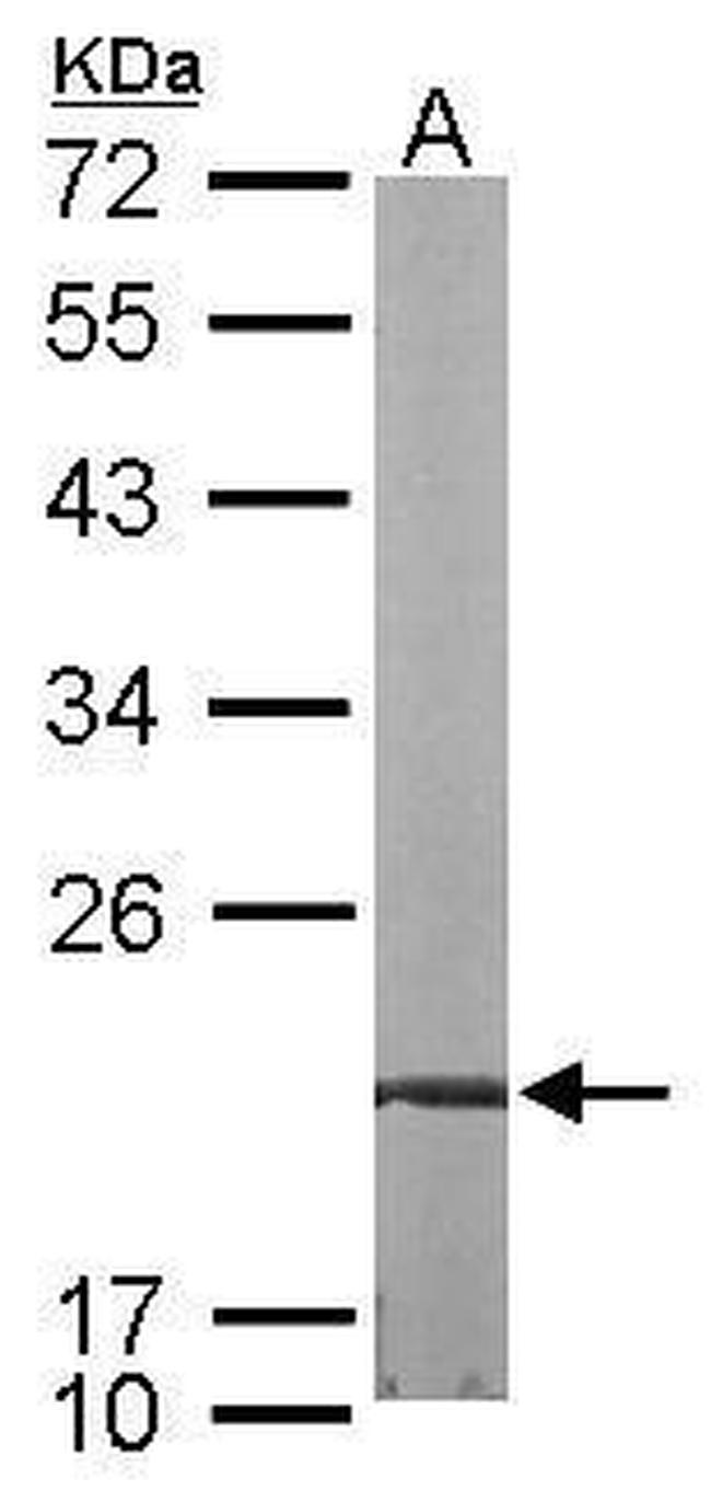 FKBP7 Antibody in Western Blot (WB)