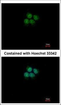 CPSF3 Antibody in Immunocytochemistry (ICC/IF)
