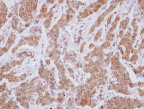 VPS29 Antibody in Immunohistochemistry (Paraffin) (IHC (P))