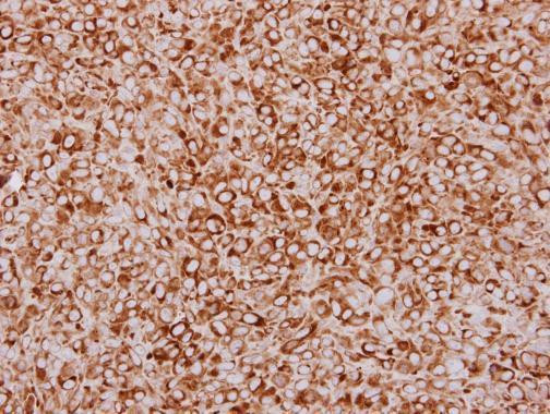 ZFYVE1 Antibody in Immunohistochemistry (Paraffin) (IHC (P))