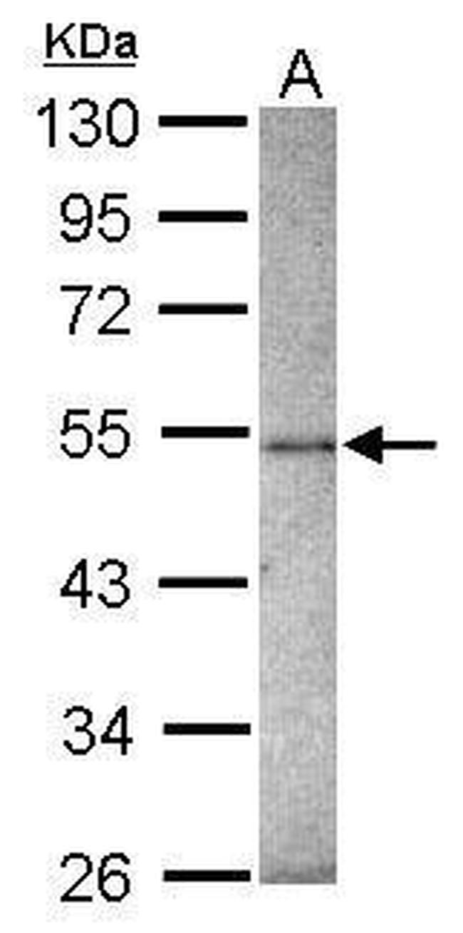 ZNF213 Antibody in Western Blot (WB)