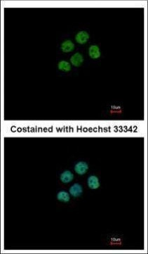 Macro H2A.2 Antibody in Immunocytochemistry (ICC/IF)