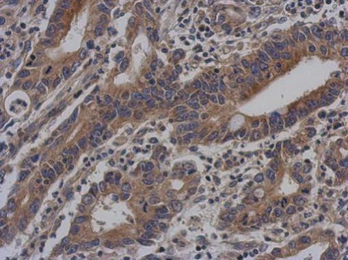 Vezatin Antibody in Immunohistochemistry (Paraffin) (IHC (P))
