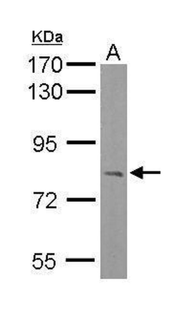 RC74 Antibody in Western Blot (WB)