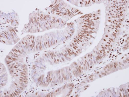 ZNF434 Antibody in Immunohistochemistry (Paraffin) (IHC (P))