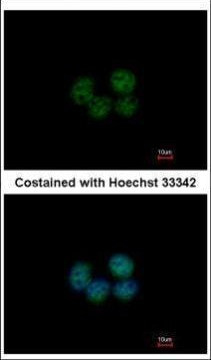 SOHLH2 Antibody in Immunocytochemistry (ICC/IF)