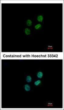 ZWILCH Antibody in Immunocytochemistry (ICC/IF)