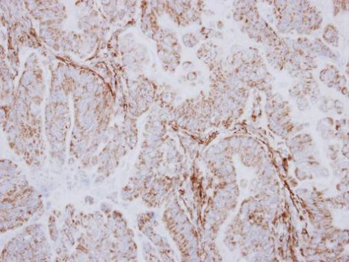AspRS Antibody in Immunohistochemistry (Paraffin) (IHC (P))