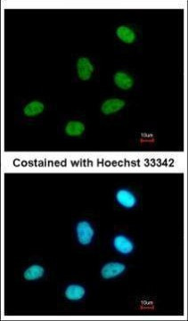 RPRD1A Antibody in Immunocytochemistry (ICC/IF)
