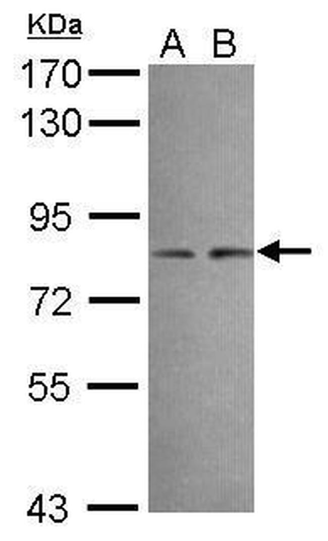 DIP13B Antibody in Western Blot (WB)