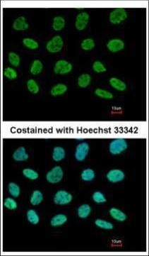 DIP13B Antibody in Immunocytochemistry (ICC/IF)