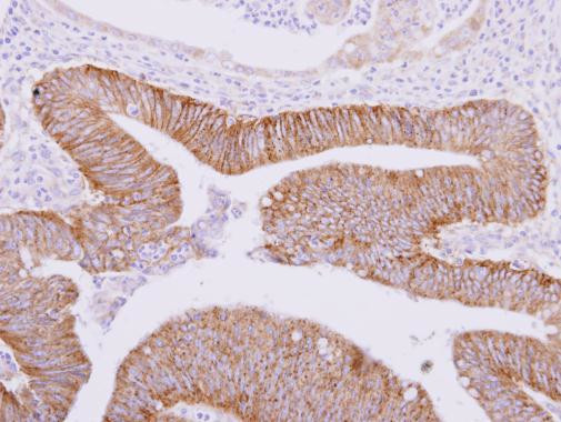 ATAD3A Antibody in Immunohistochemistry (Paraffin) (IHC (P))