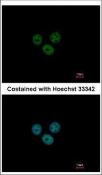RCBTB1 Antibody in Immunocytochemistry (ICC/IF)