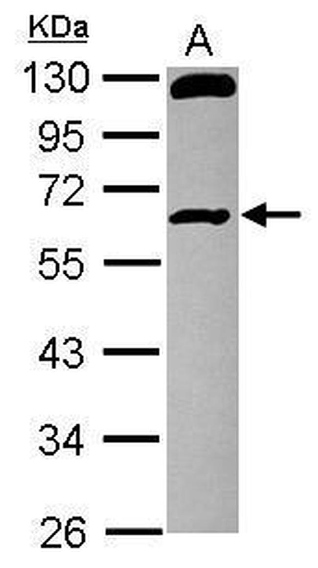 RCBTB1 Antibody in Western Blot (WB)