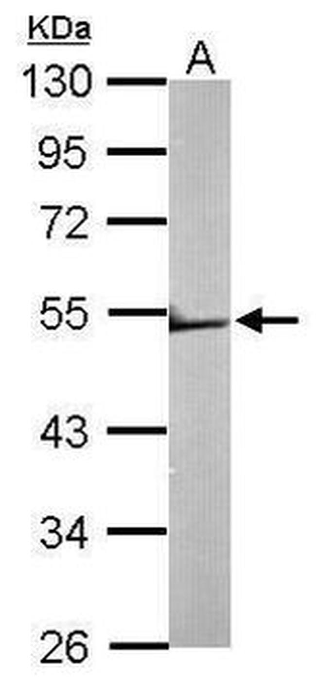 TRIM62 Antibody in Western Blot (WB)