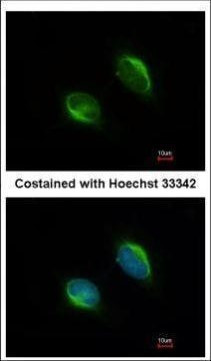 TYW1 Antibody in Immunocytochemistry (ICC/IF)