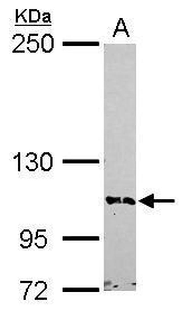 BRD1 Antibody in Western Blot (WB)