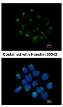 CNDP2 Antibody in Immunocytochemistry (ICC/IF)