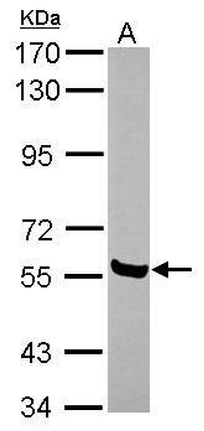 AMIGO1 Antibody in Western Blot (WB)