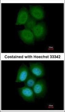 NXF3 Antibody in Immunocytochemistry (ICC/IF)