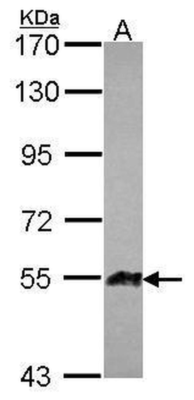 ANGPTL1 Antibody in Western Blot (WB)