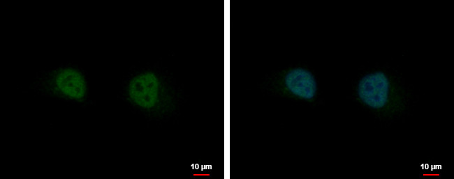 GIT2 Antibody in Immunocytochemistry (ICC/IF)