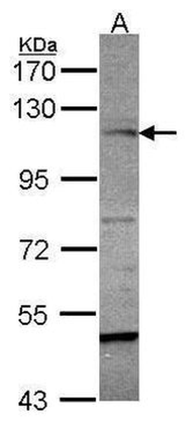 JMJD2A Antibody in Western Blot (WB)