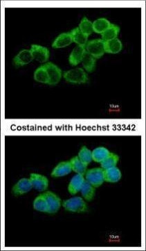 UBASH3A Antibody in Immunocytochemistry (ICC/IF)