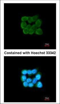 TOMM34 Antibody in Immunocytochemistry (ICC/IF)
