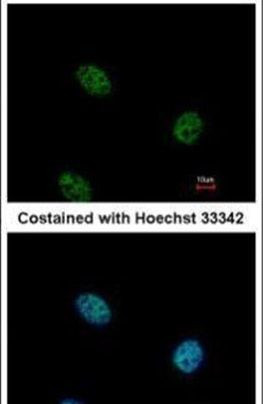 EHF Antibody in Immunocytochemistry (ICC/IF)