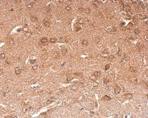 Chromogranin C Antibody in Immunohistochemistry (Paraffin) (IHC (P))