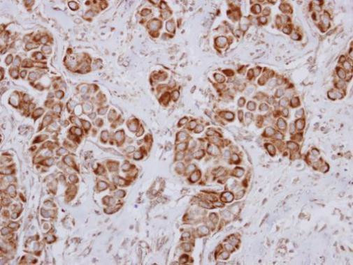 PRKD3 Antibody in Immunohistochemistry (Paraffin) (IHC (P))