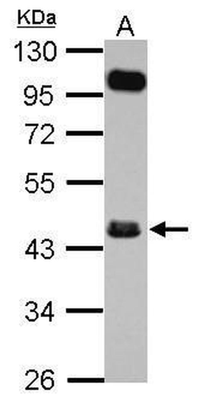 FCRLA Antibody in Western Blot (WB)