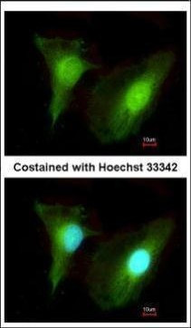 SMYD2 Antibody in Immunocytochemistry (ICC/IF)
