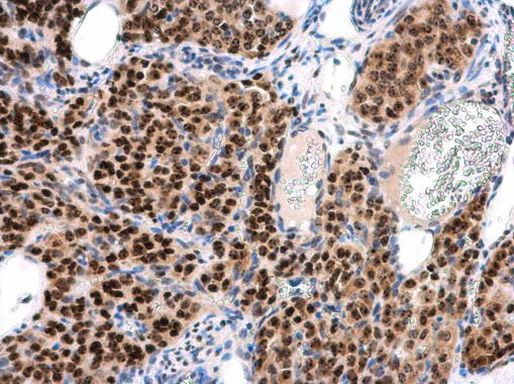 INTS4 Antibody in Immunohistochemistry (Paraffin) (IHC (P))