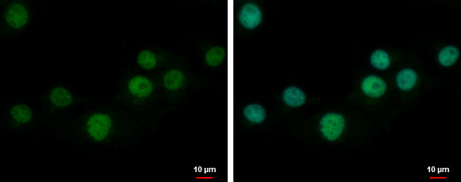 ZNF501 Antibody in Immunocytochemistry (ICC/IF)