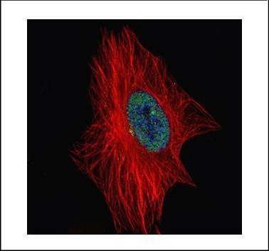 ZNF449 Antibody in Immunocytochemistry (ICC/IF)