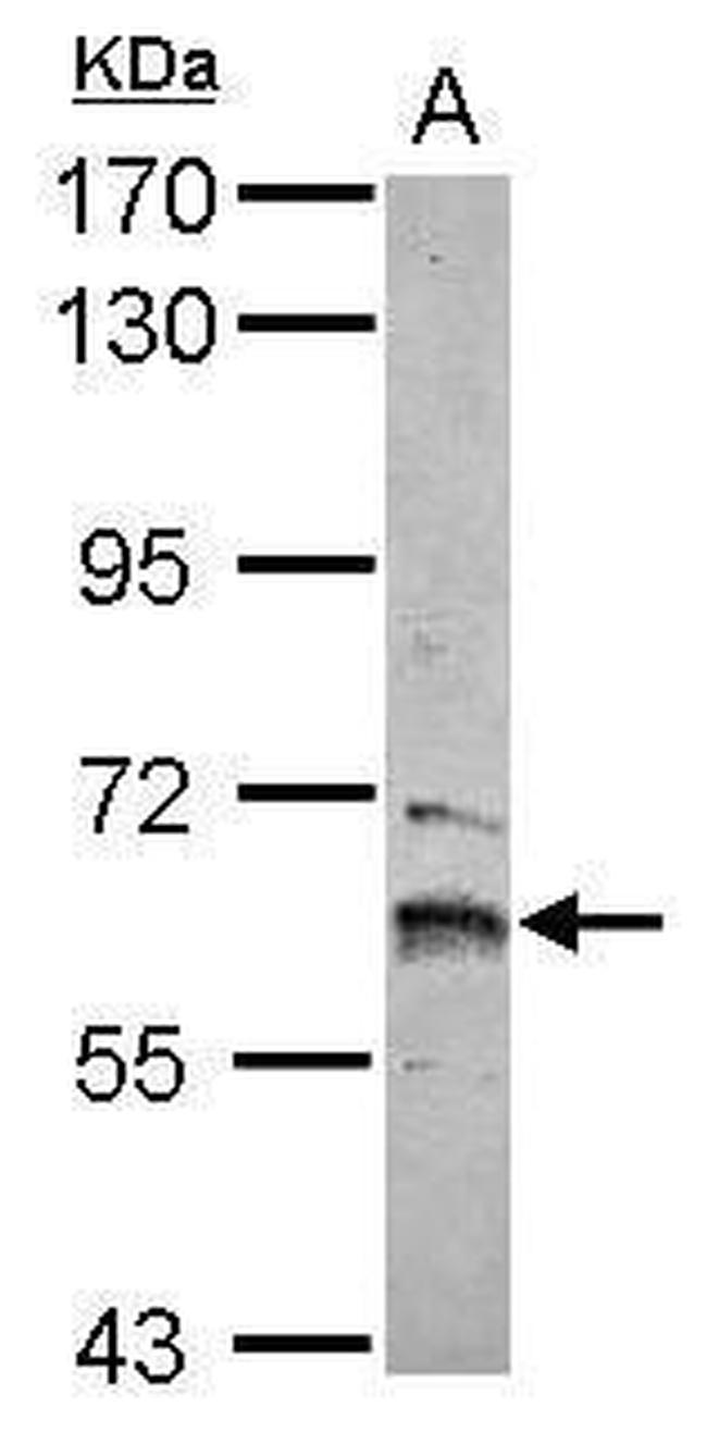 ZNF83 Antibody in Western Blot (WB)