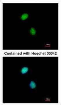 POLE3 Antibody in Immunocytochemistry (ICC/IF)