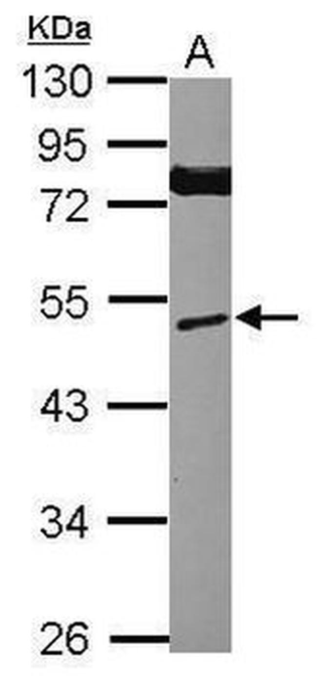 Mig-6 Antibody in Western Blot (WB)