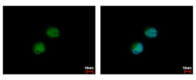 PRMT7 Antibody in Immunocytochemistry (ICC/IF)