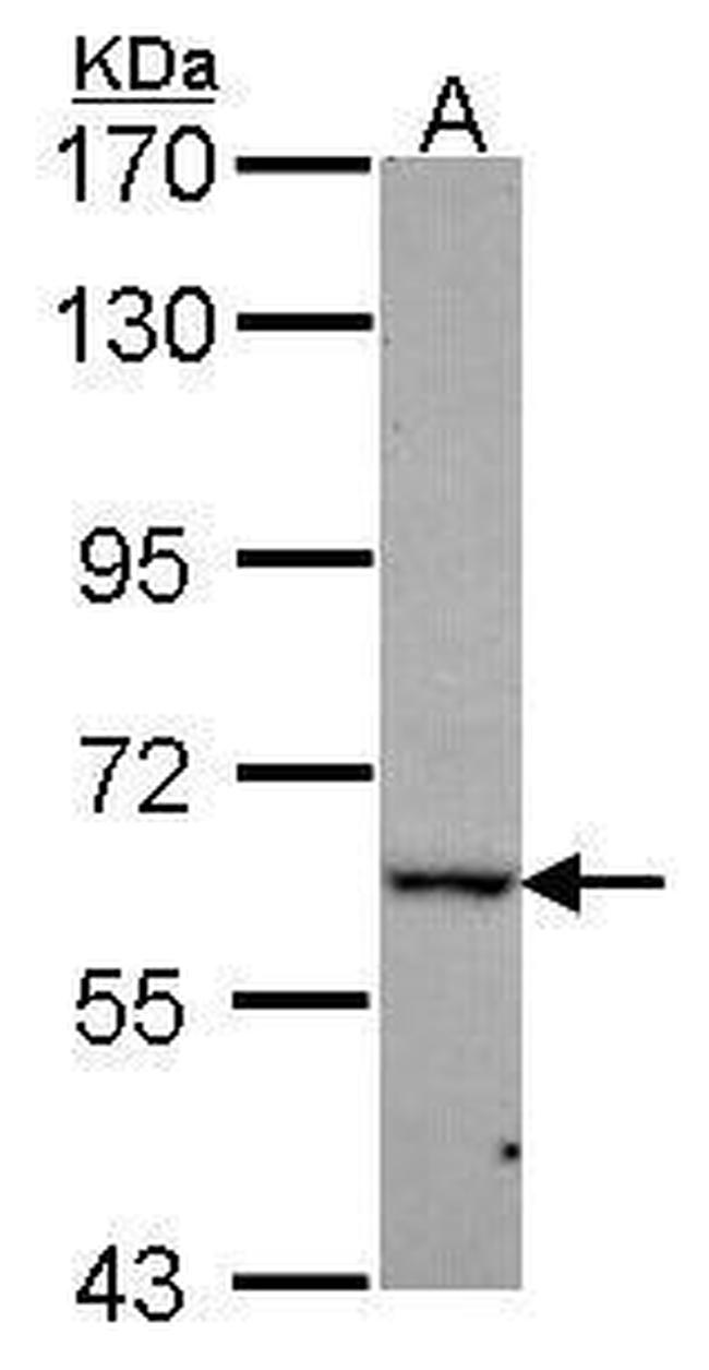 DDX56 Antibody in Western Blot (WB)