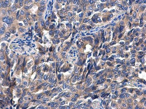 P4HTM Antibody in Immunohistochemistry (Paraffin) (IHC (P))